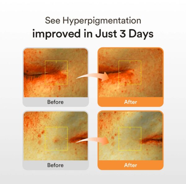 Abib Glutathiosome dark spot serum