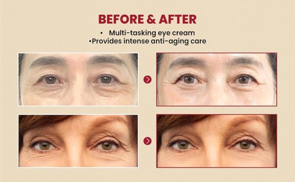 SEOUL 1988 Eye Cream : Retinal Liposome 4% + Fermented Bean