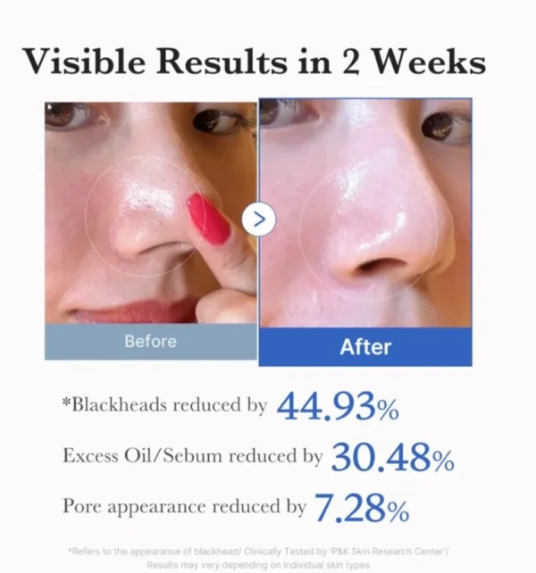 img_6460-768x822 Medicube Zero Pore Pad 2.0